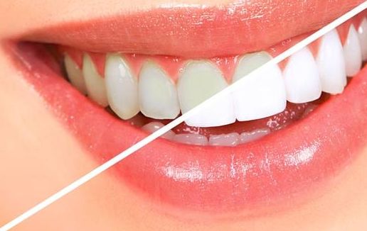 深圳哪家醫(yī)院治療酒糟鼻效果好，哪家醫(yī)院專業(yè)治療酒糟鼻最好