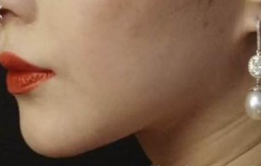 廣州光子嫩膚治療紅血絲效果好的醫(yī)院有哪些口碑推薦？2023年廣州美容醫(yī)院揭秘十家專業(yè)醫(yī)療機(jī)構(gòu)發(fā)布！