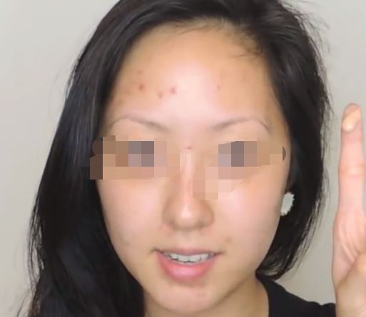 重慶消除魚尾紋凹陷前10家好評如潮整形機構(gòu)大評比