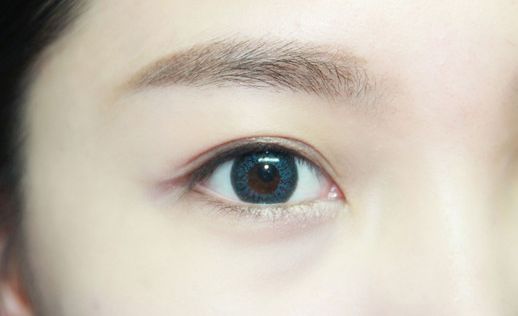 伊婉玻尿酸的出身及作用：進(jìn)口？價(jià)格及效果如何