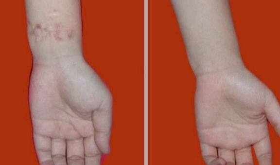 淄博下眼瞼成形術(shù)醫(yī)院前十強(qiáng)推薦，打造電力十足雙眼