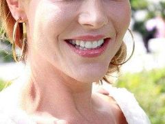 無錫注射填充祛眼紋好評醫(yī)院榜單：專業(yè)專家推薦