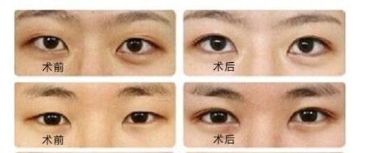 吉林市隆胸案例推薦：Top6整形醫(yī)院，專業(yè)選擇有保障