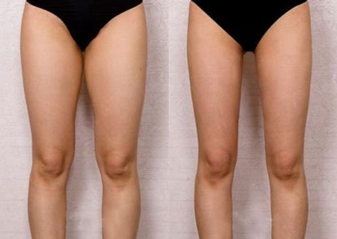 濱州哪家美容醫(yī)院皮秒去妊娠紋口碑最佳？Top10排名公布