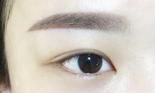 鄭州哪家醫(yī)院做面部吸脂好？