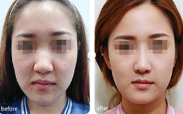 武漢射頻祛除眼底皺紋權(quán)威醫(yī)院10強(qiáng)推薦