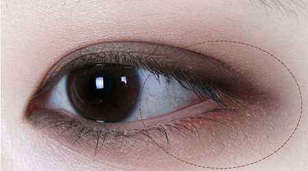 廣州飛悅整形醫(yī)療美容醫(yī)院值得信賴嗎？知名專家醫(yī)生為您解答！