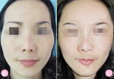 廣州上眼角提升不容錯(cuò)過(guò)！權(quán)威專(zhuān)家推薦十佳醫(yī)美機(jī)構(gòu)