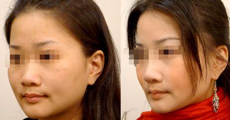 鄭州自體細胞嫩膚整形醫(yī)院 TOP 10 排名榜：修復受損年輕 肌