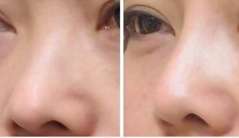 西安最受歡迎的頸部美容醫(yī)院排行榜，專業(yè)口碑匯總