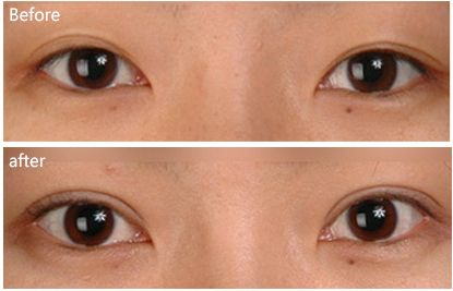 錦州外陰整形醫(yī)院哪家效果最好又靠譜？