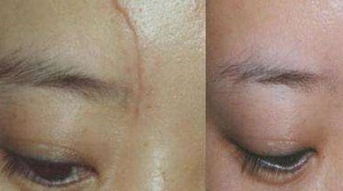 張曉玲整容成功了嗎？探索她的變化與心態(tài)轉(zhuǎn)變