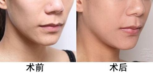 蘭州哪家醫(yī)院治療小腿浮腫效果好？