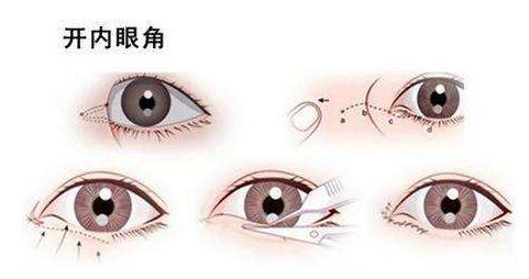 蘇州哪家醫(yī)院整形科好？選擇合適整形醫(yī)院，打造完美容顏。