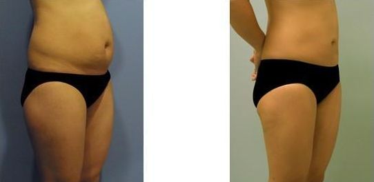 淮北市哪家醫(yī)院眼科專家好？