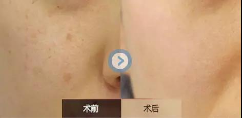 2023張家港蘋果肌復(fù)位提升前十強醫(yī)院，哪幾家值得選擇？讓您肌膚回復(fù)細膩緊致！