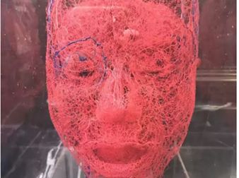 濟南城優(yōu)秀的雙眼皮整形專家匯總！