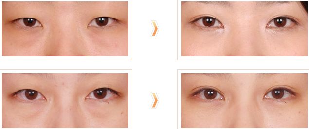 洛陽市專業(yè)祛疤醫(yī)院哪家好？洛陽市祛疤醫(yī)院排名及推薦