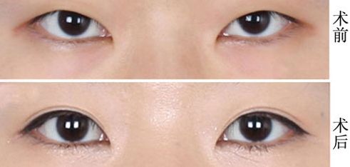 上海哪家醫(yī)院疤痕修復(fù)效果好？