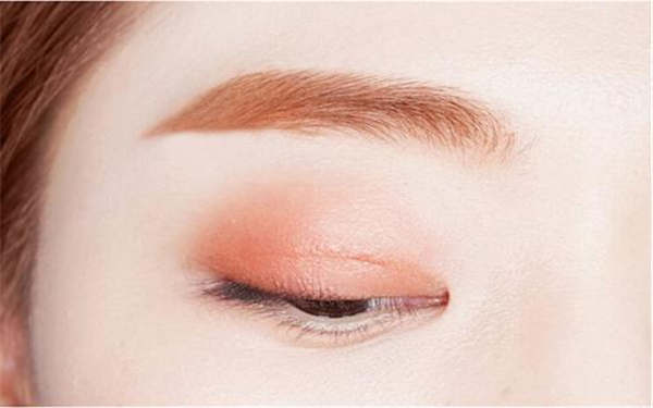 雙美膠原蛋白注射豐唇果效如何？維持時間長久嗎？需注意哪些事項？