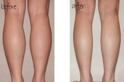 2023年宿遷治療雀斑整形美容醫(yī)院口碑排行榜，推薦您去哪里？