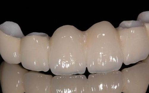 南京哪家醫(yī)院做假體隆鼻手術(shù)效果好