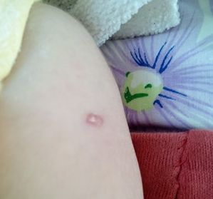 淄博割雙眼皮哪家醫(yī)院好？選擇正規(guī)醫(yī)院，安全放心！