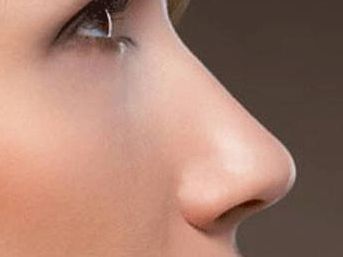 昆明祛除雀斑醫(yī)院哪家好？探尋昆明當(dāng)?shù)貙I(yè)雀斑去除醫(yī)院推薦