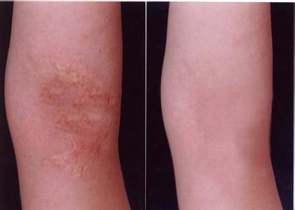 重慶十佳眼部除皺激光整形醫(yī)院大揭秘