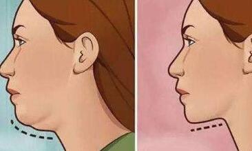 如何通過(guò)抽脂手術(shù)告別眼袋，重塑年輕容顏？