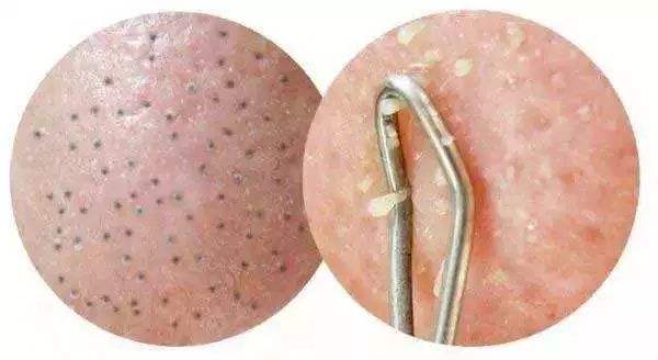 2023年永州乳房下垂修復(fù)效果好的醫(yī)院推薦，榜單前十靠譜選擇！