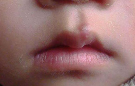 濰坊豐胸哪家整形醫(yī)院靠譜？