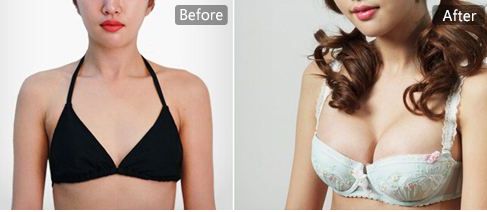 蘇州祛痘效果最好的醫(yī)院有哪些？