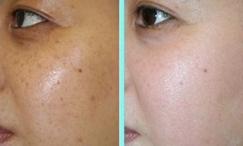 沈陽(yáng)哪家醫(yī)院的面部整形效果好？