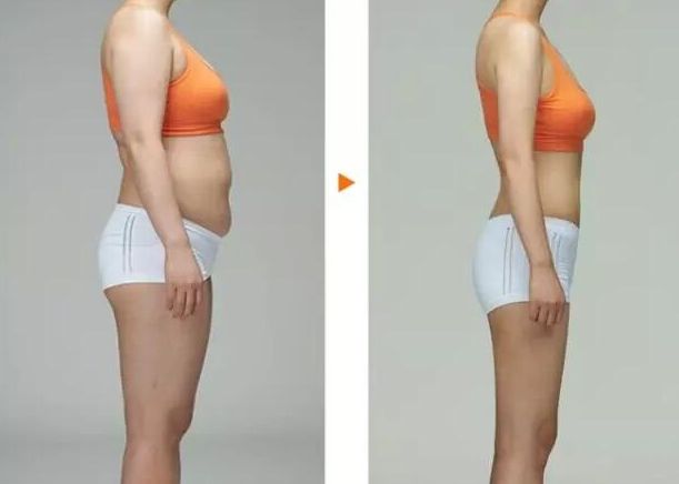 吉林哪家醫(yī)院做小腿溶脂減肥效果好？口碑推薦排行榜TOP10