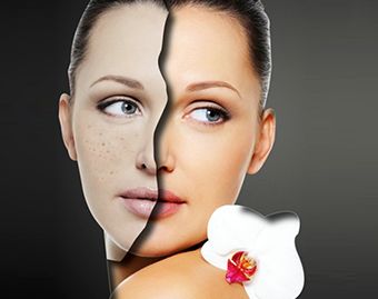 西安哪家醫(yī)院能改善面部下垂效果好？Top醫(yī)院排名揭曉