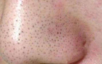 甘肅骨雕祛除魚尾紋排行榜：前10家技術(shù)精湛醫(yī)院盤點