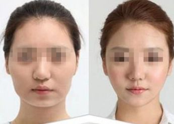 洛陽(yáng)最佳發(fā)際線矯正整形醫(yī)院排行榜TOP10大揭秘