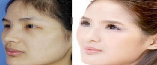 上海溶脂針瘦腰醫(yī)院口碑推薦10強(qiáng)榜單