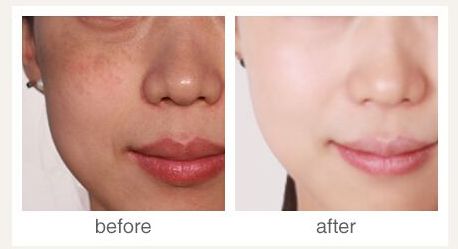 杭州有哪些專業(yè)治療疤痕的醫(yī)院？-杭州看疤痕的醫(yī)院哪家好？