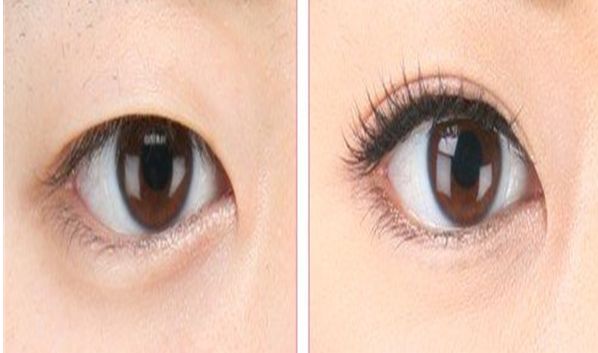 新鄉(xiāng)哪家醫(yī)院做激光好？專業(yè)醫(yī)生為您詳細(xì)解讀！