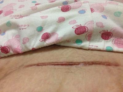 哈爾濱面部微電波拉皮哪家醫(yī)院靠譜？2023年前10家美容整形醫(yī)院排行榜！