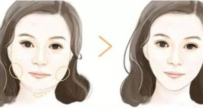 青島面部痣痕祛除醫(yī)院排行榜：權(quán)威揭曉公立&私立前10強(qiáng)