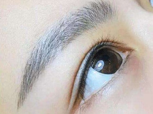 拓展：18歲了還需要考慮整容嗎？