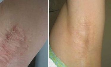 張檬是否真的承認(rèn)整容了？揭秘明星整容疑云