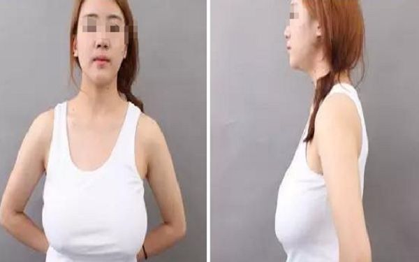 北京微雕淡化口周紋口碑佳選：10家實(shí)力醫(yī)院推薦