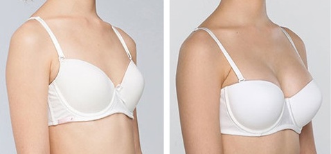 威海眼底細(xì)紋注射玻尿酸哪家醫(yī)院技術(shù)好又具有知名度？2023年威海眼底細(xì)紋注射玻尿酸醫(yī)療整形醫(yī)院前十強(qiáng)推薦