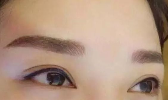 青島哪家植發(fā)醫(yī)院效果好？發(fā)際線種植費用介紹