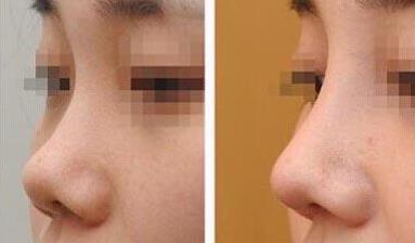 清遠(yuǎn)有哪些醫(yī)院是整容專業(yè)的？其中前十名的整容醫(yī)院是哪些？手術(shù)費用怎樣？