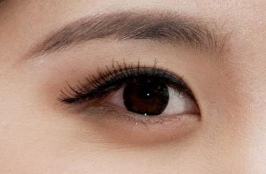 開內(nèi)眼角后是否真的會留下疤痕？